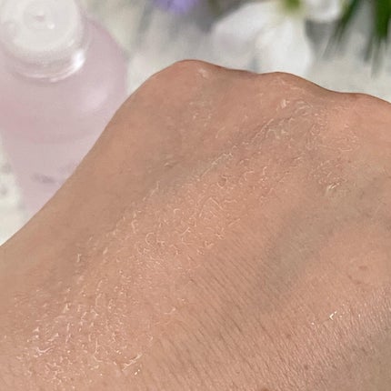 薬用アクアコラーゲンゲル スーパーセンシティブEX/ドクターシーラボⓇ/オールインワン化粧品を使ったクチコミ(5枚目)