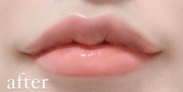 ゆんのこ on LIPS 「💋唇ケアについて💋□気になる唇の縦ジワ予防におすすめのアイテム..」（2枚目）