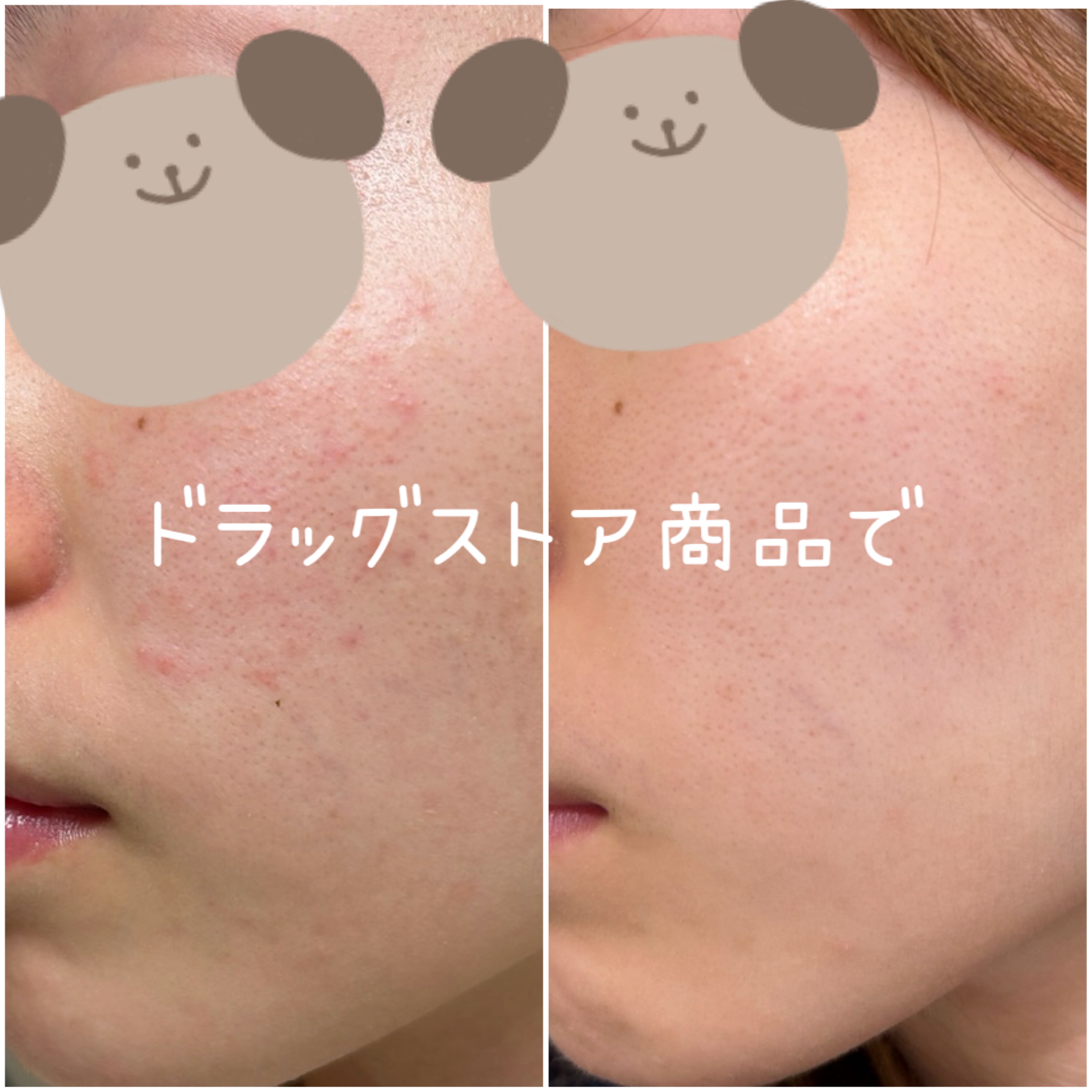 ビオレ おうちdeエステ メイク落とし マッサージブラックジェル/ビオレ/クレンジングジェルを使ったクチコミ（1枚目）