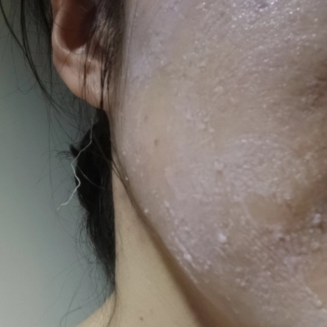 ピンクティーツリーライスシカウォッシュオフパック/APLIN/洗い流すパック・マスクを使ったクチコミ(3枚目)