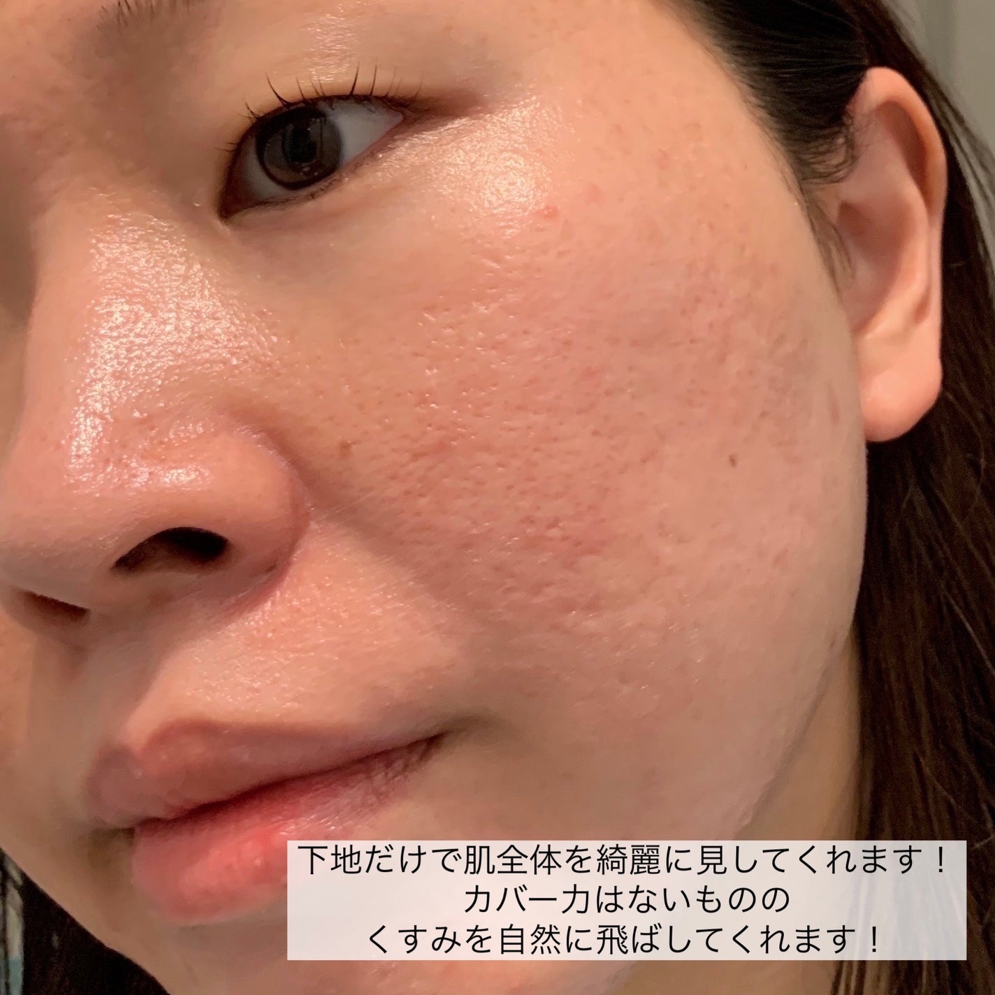 UVã€ã㢠XL ãããã¯ã·ã§ã³ããŒã³ã¢ãã/ã© ããã·ã¥ ããŒ/æ¥çŒãæ¢ãã¯ãªãŒã ã䜿ã£ãã¯ãã³ãïŒ5æç®ïŒ