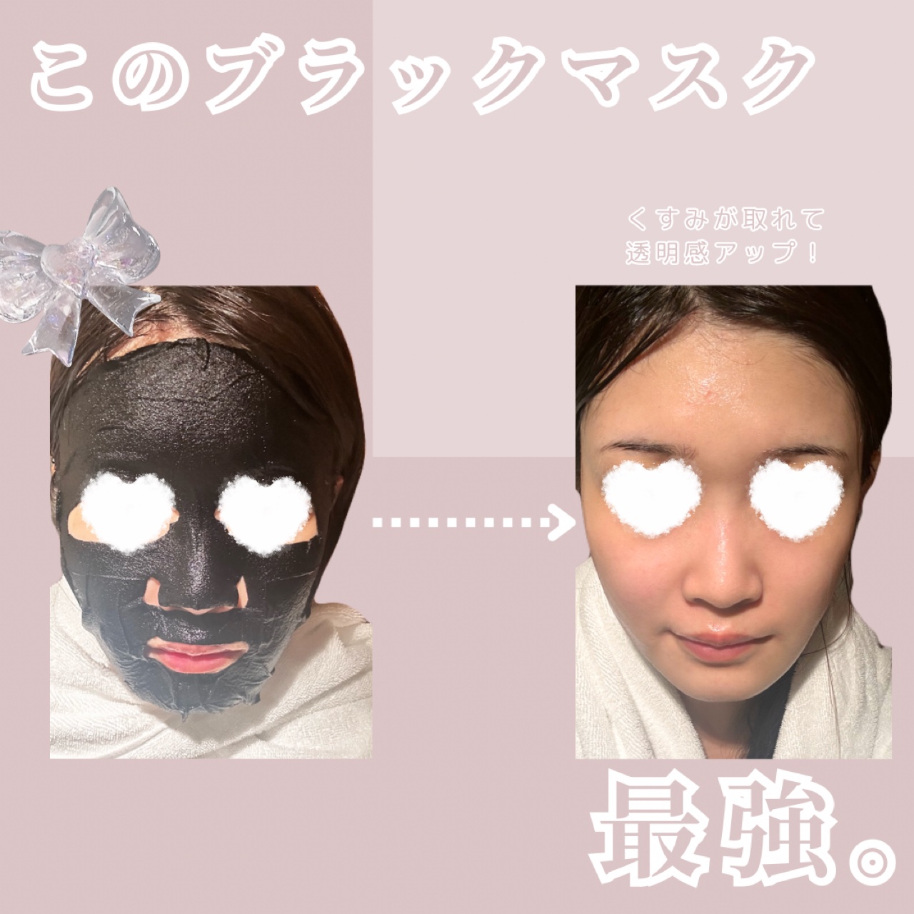 【くすみを飛ばす！！透明感がアップするフェイスマスク】

【くすみを飛ばす！！透明感がアップするフェイスマスク】

こんにちはー！
今回は MEDIHEALのW.H.PホワイトハイドレイティングブラックマスクEX をご紹介します！！

この