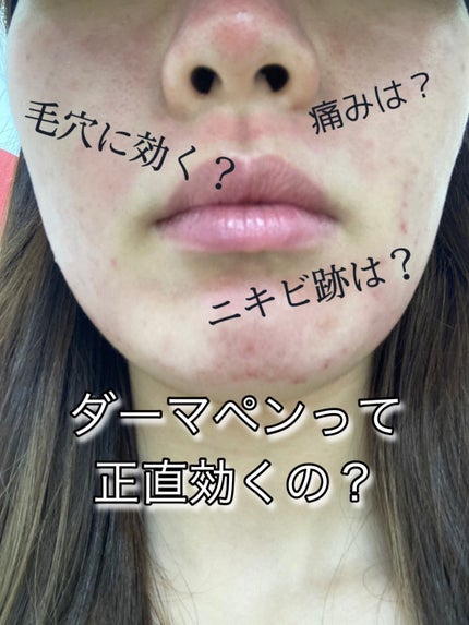 ベビーワセリン/健栄製薬/ボディクリームを使ったクチコミ(1枚目)