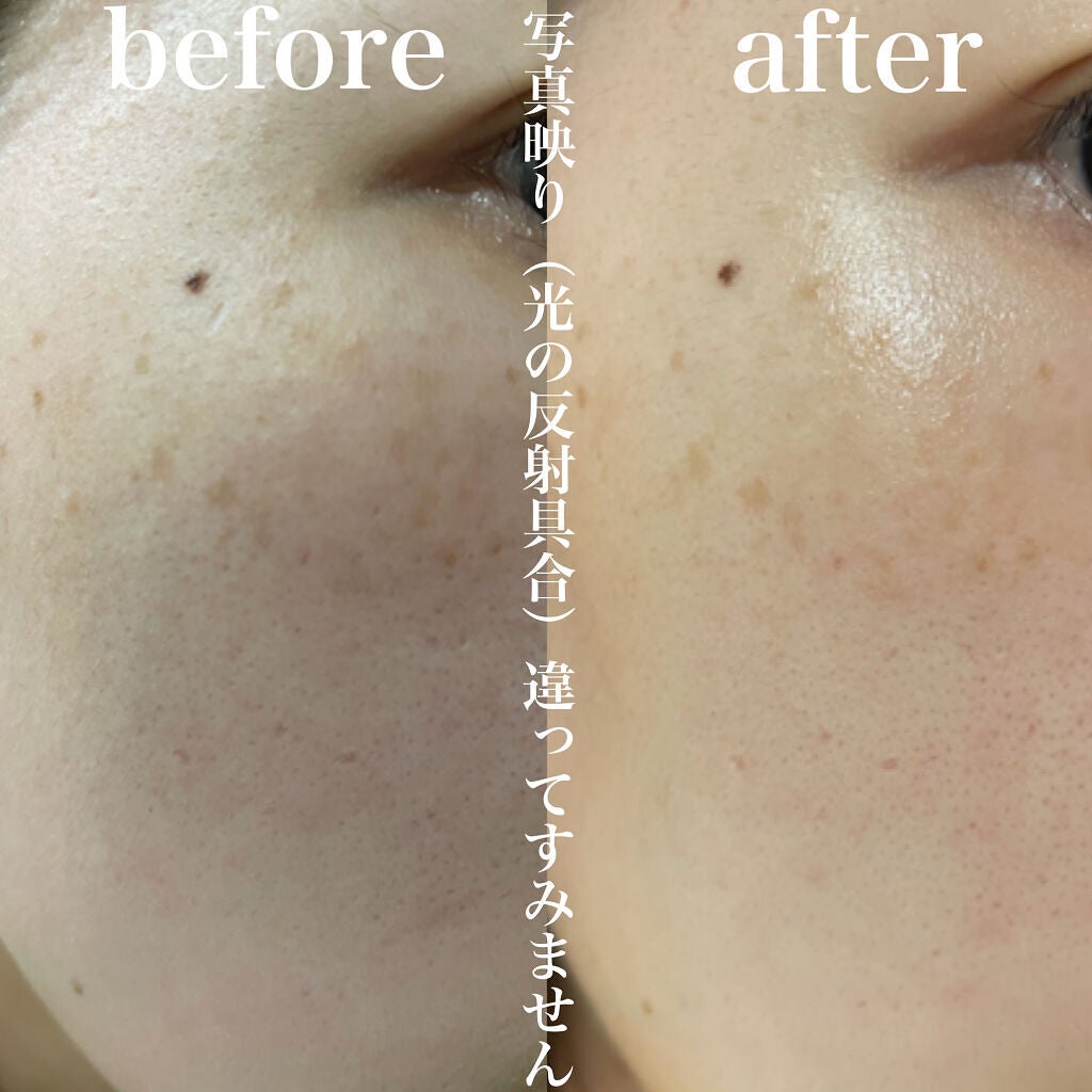 薬用しみ集中対策 プレミアム美容液/メラノCC/美容液を使ったクチコミ(2枚目)