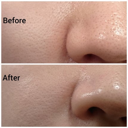 CARE-NA*ホットクールジェル/オルビス/洗い流すパック・マスクを使ったクチコミ(2枚目)