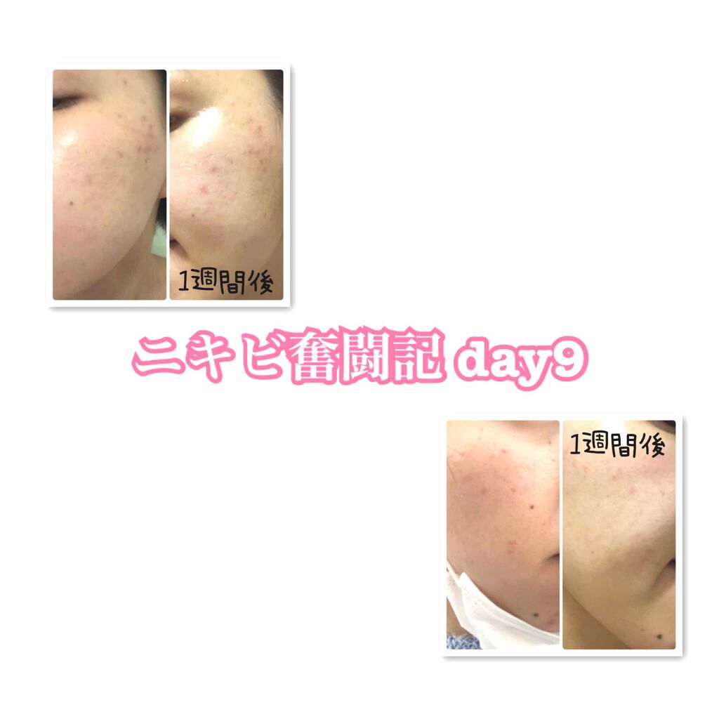 たまご on LIPS 「肌質改善を心に決めてから約10日間が経過しました🤫新生活が始ま..」(1枚目)