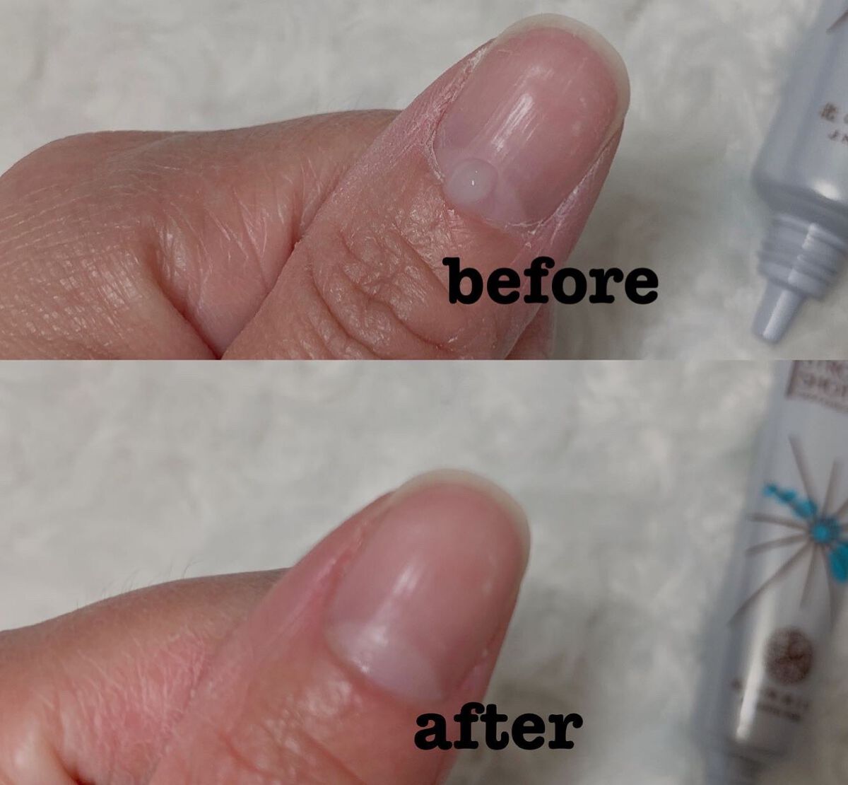 クリアショットストロング 北の快適工房 クリアストロングショット アルファ 15g＋クリアフット