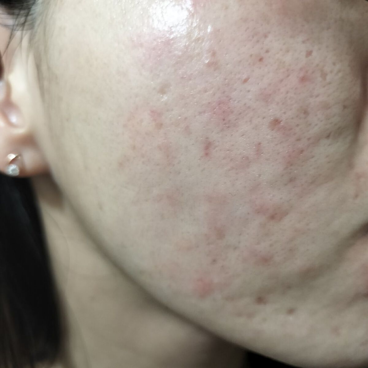 ビオオイル アルガンオイル/Melvita/フェイスオイルを使ったクチコミ（1枚目）