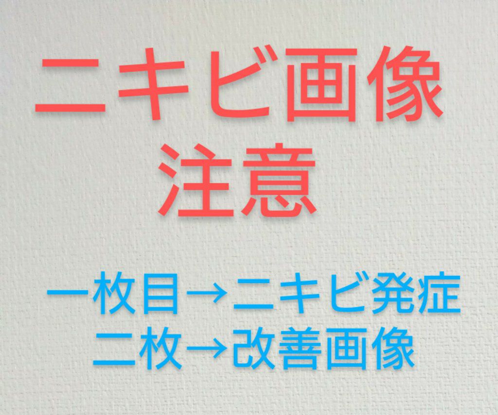 オロナインＨ軟膏 (医薬品)/オロナイン/その他を使ったクチコミ（1枚目）
