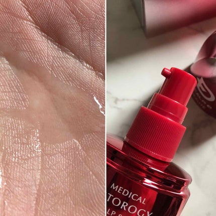 スカルプD ボーテ メディカルエストロジー スカルプセラム/アンファー(スカルプD)/頭皮ローションを使ったクチコミ(2枚目)