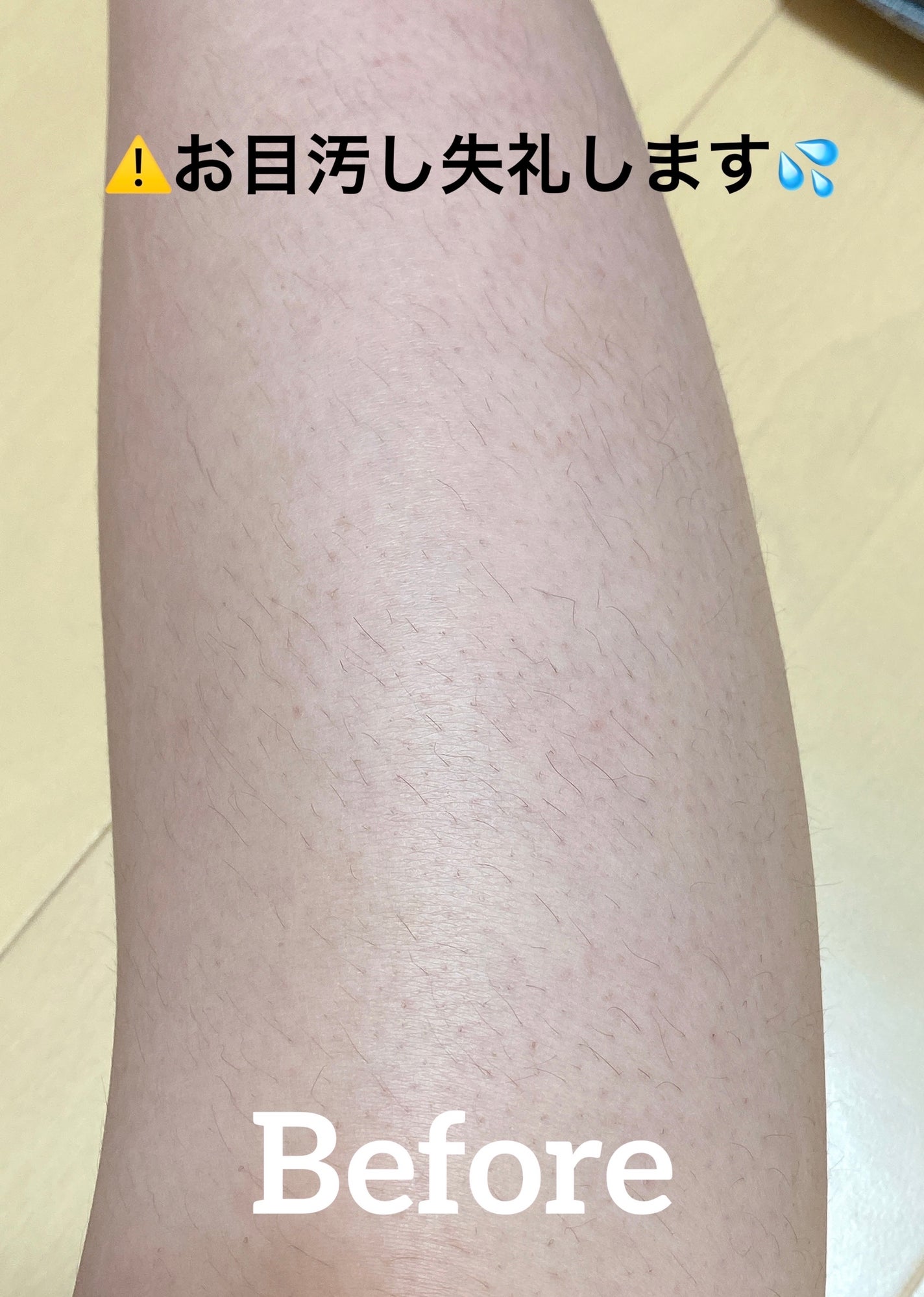 ミュゼコスメ メンズ 薬用ヘアリムーバルクリーム ホワイトシトラスの香り/ミュゼコスメ/除毛クリームを使ったクチコミ(5枚目)