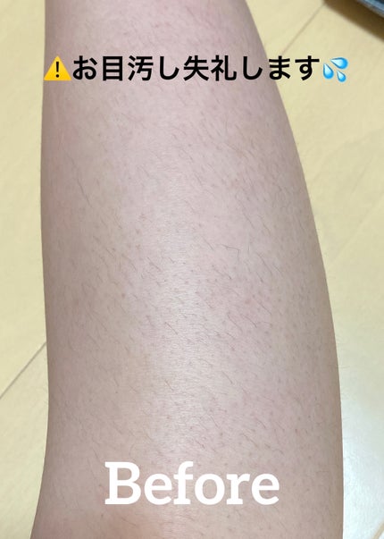 ミュゼコスメ メンズ 薬用ヘアリムーバルクリーム ホワイトシトラスの香り/ミュゼコスメ/除毛クリームを使ったクチコミ(5枚目)