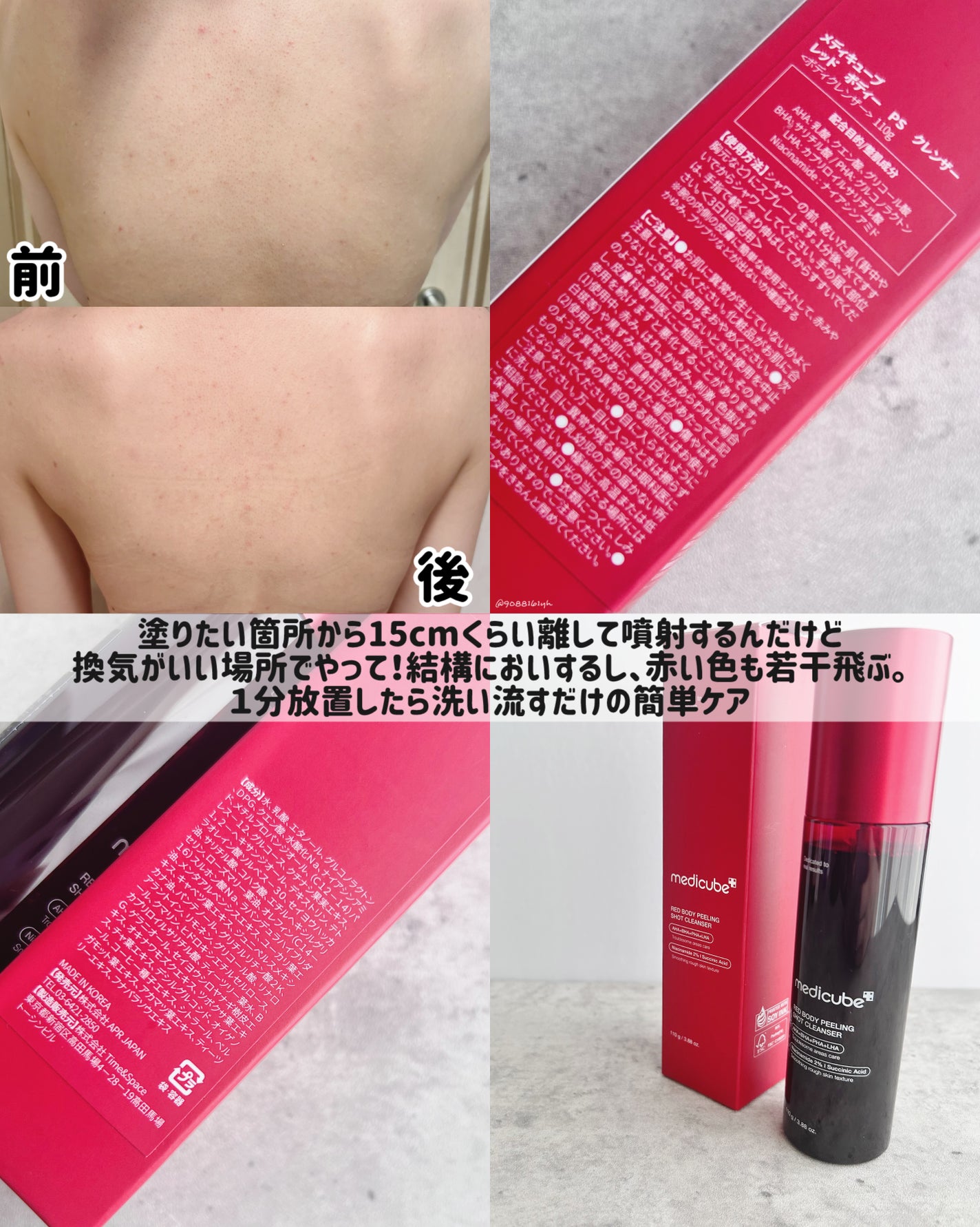 レッドアクネ ボディピーリングショット/MEDICUBE/ピーリングを使ったクチコミ(4枚目)