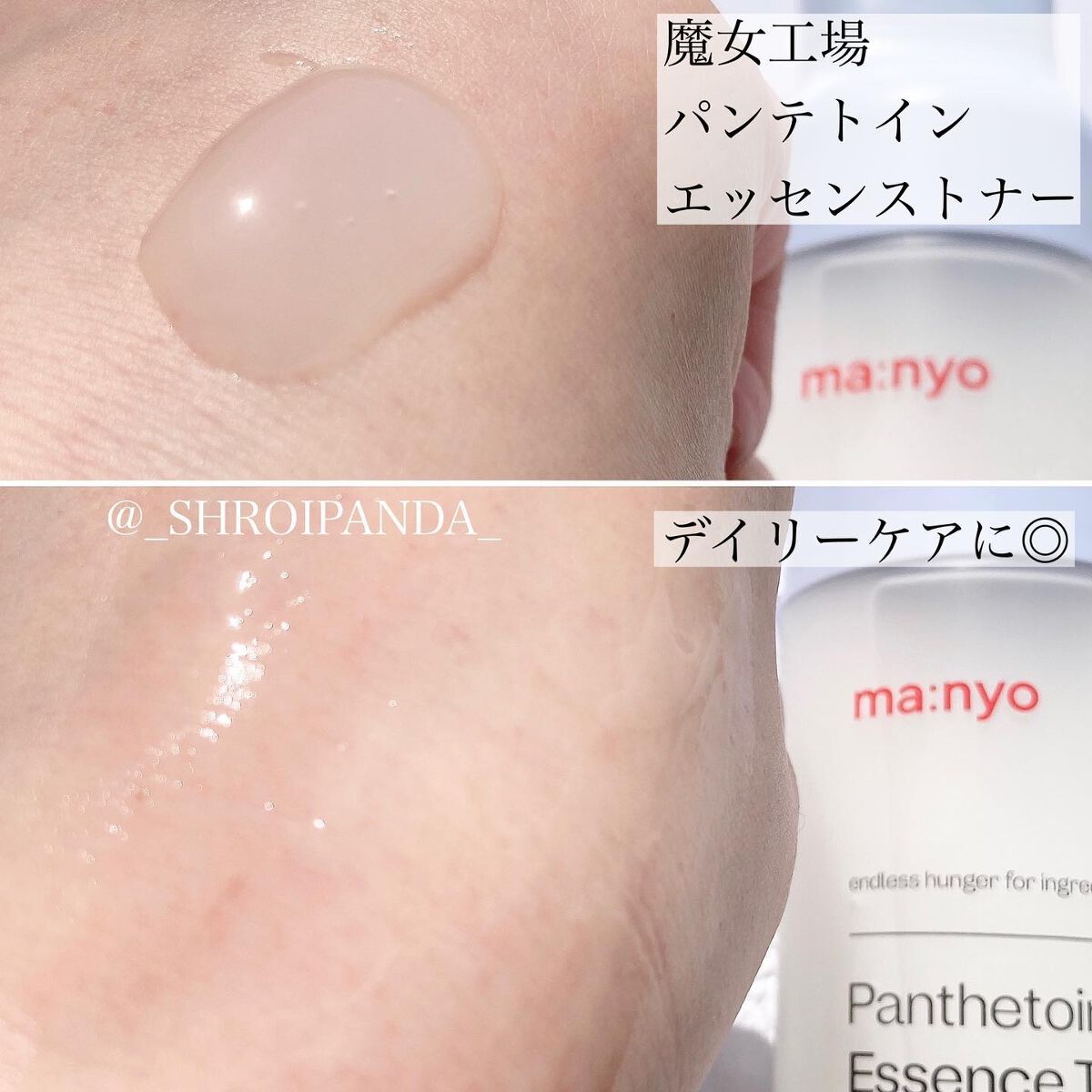 パンテトイン エンリッチド バーム/manyo/フェイスバームを使ったクチコミ（3枚目）