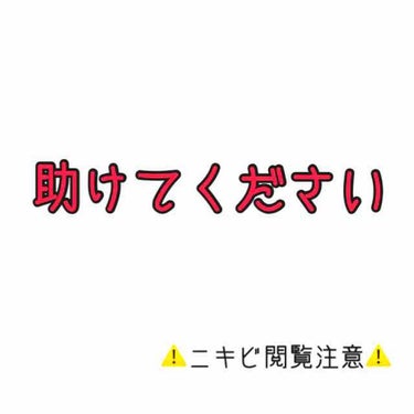 まぬるねこ on LIPS 「無加工インカメでとりました。まじで汚肌。リアルで私より汚い人見..」（1枚目）