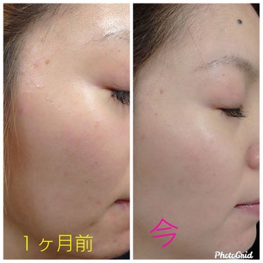 サンホワイトp 1 サンホワイトの口コミ こんばんは お久しぶりです By Mari 敏感肌 代後半 Lips サンホワイトp 1 サンホワイトの口コミ こんばんは お久しぶりです By Mari 敏感肌 代後半 Lips
