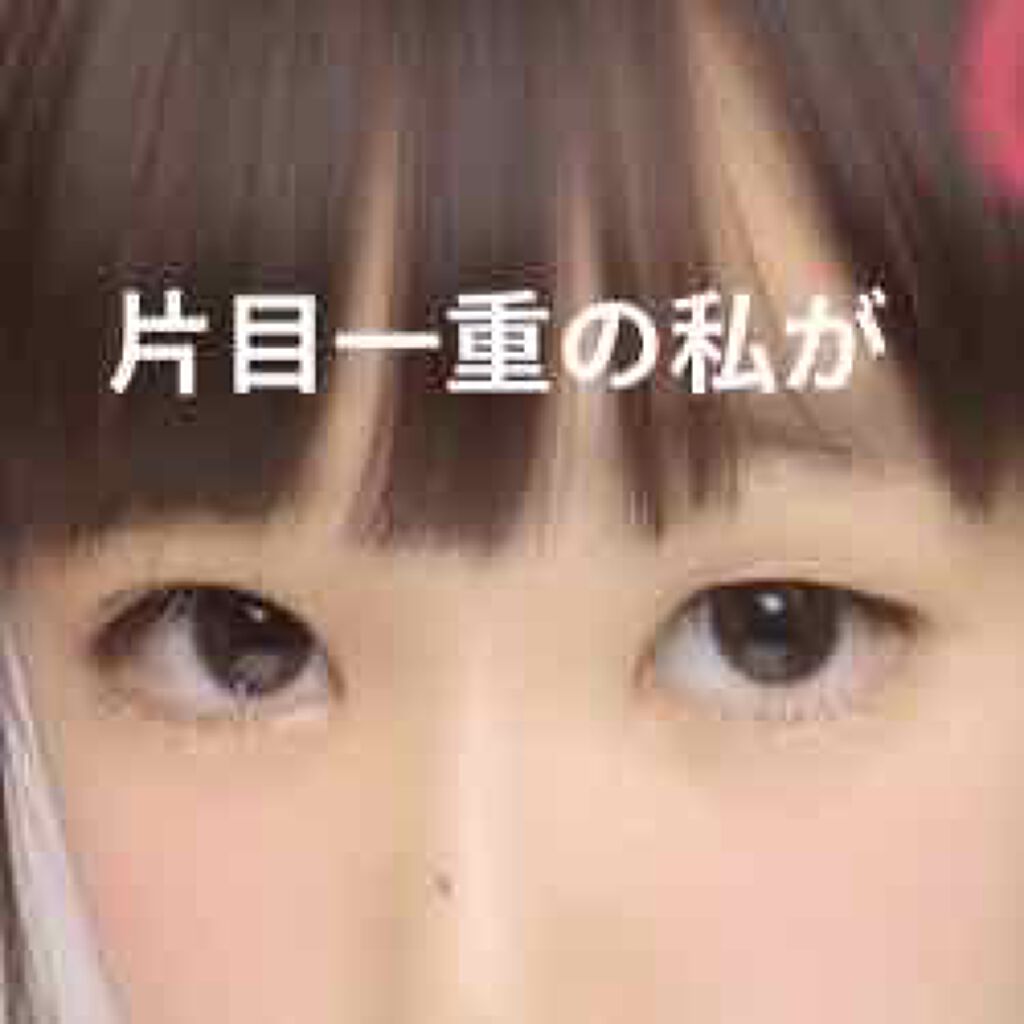 アイトーク アイトークの口コミ 片目一重の私が綺麗な二重を手に入れれた方法 By りちょ 普通肌 10代後半 Lips