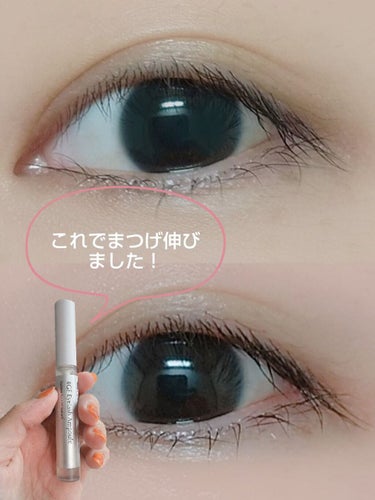 MANYO FACTORY 魔女工場
4GF Eyelash Ampoule

魔女工場の限定セットについていたものです
１ヶ月位使用してみました
はじめはあまり変化がないなぁと思っていたのですが2週間位した辺りから伸びてきたなぁと感じました
全体的にまつ毛が濃くなって、上のまつ毛は伸びました
ですが下まつ毛はあまり変化がないような…
あとこれのせいかは分かりませんが少し毛が抜けやすくなったような…😅
あとブラシは少し太くて塗りづらいかも
ですがしっかり伸びてくれたので効果はあるなと思いました
の画像 その0