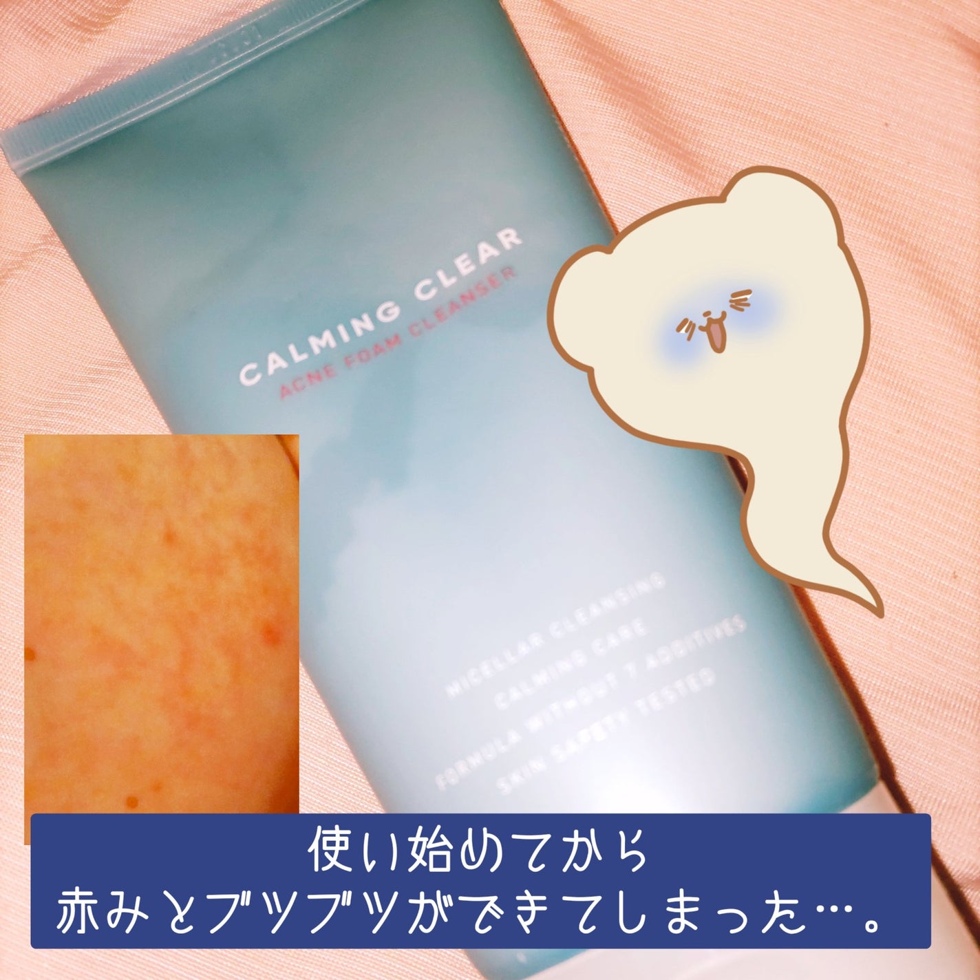 クレンジングフォーム(トラブルケア/敏感性肌・ニキビ肌)/LEADERS/洗顔フォームを使ったクチコミ(1枚目)