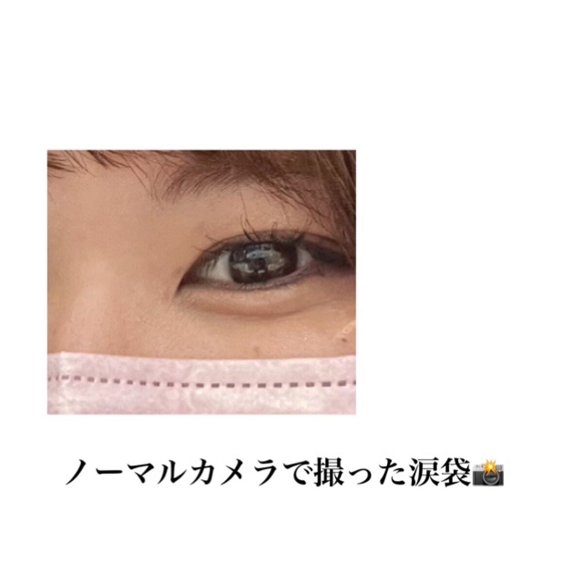 ティーツリーカーミングエッセンスパッド/MEDIHEAL/トナーパッドを使ったクチコミ（3枚目）