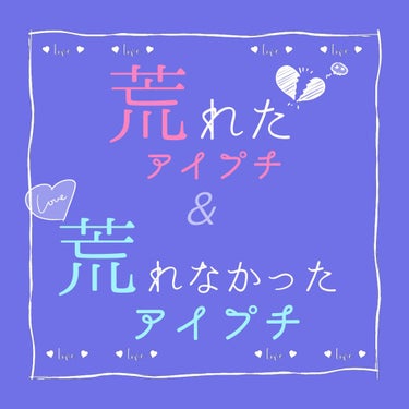 《肌の弱い私が使ったことのある二重アイテム》

今回は、肌の弱い私が使用したことのあるアイプチの、荒れたものと荒れなかった物を簡単に紹介します🐵

【おさるの瞼スペック】
・左目が二重、右目が一重のため