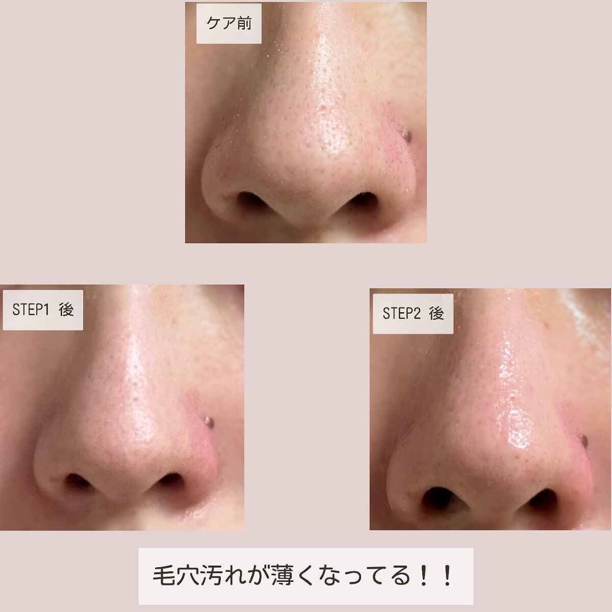 2STEP 鼻パック/anyism/その他スキンケアを使ったクチコミ(7枚目)