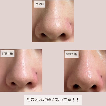 2STEP 鼻パック/anyism/その他スキンケアを使ったクチコミ(7枚目)