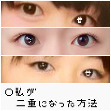 今回は私の二重になった方法を紹介したいと思いまふ！！！😎😎
※個人差あり


といってもほんとにやることは一つ。
夜寝る前に必ず必ず必ずかならーーーーーーーーーーーずアイテープを自分がなりたい二重幅に貼