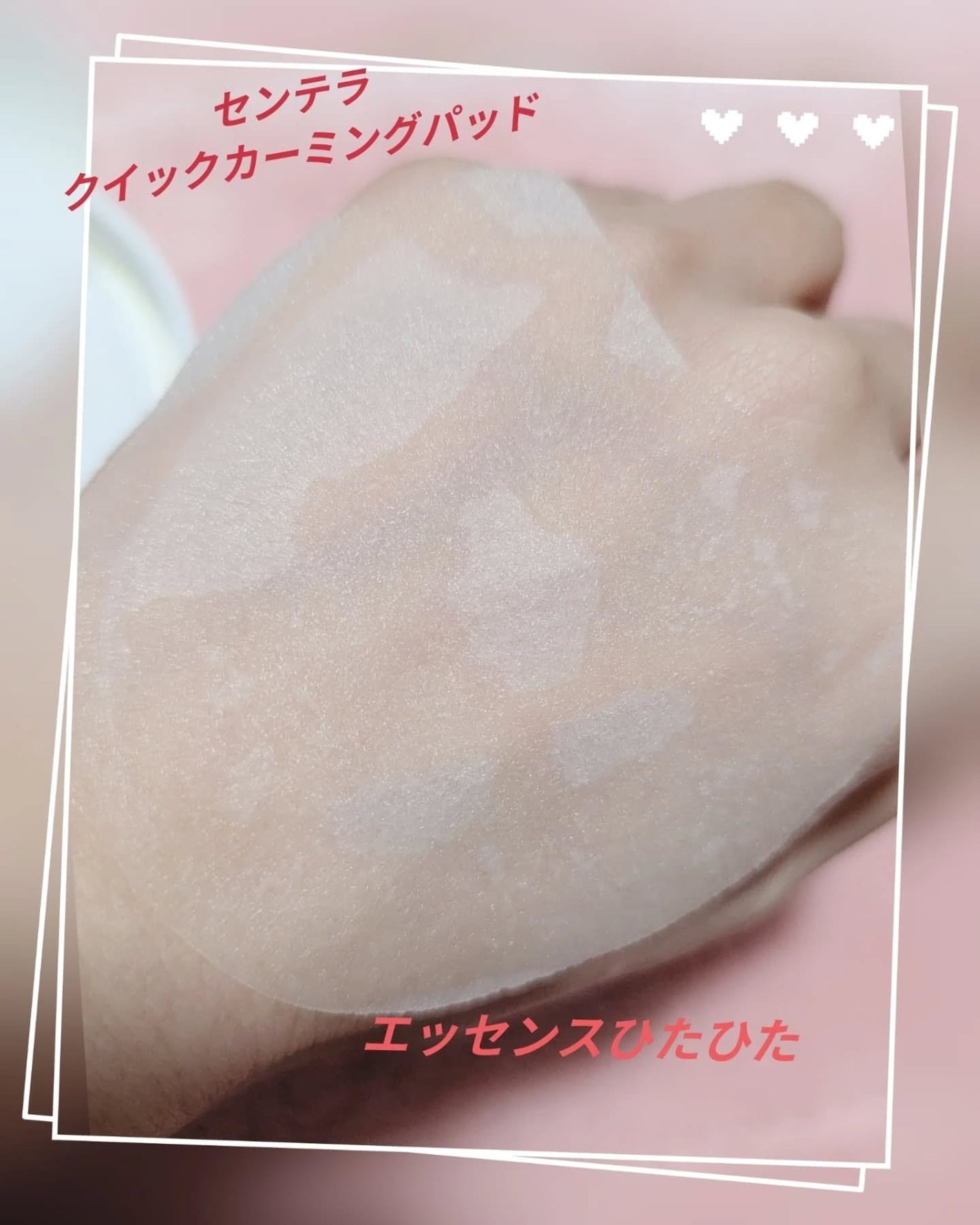 センテラ クイックカーミングパッド/SKIN1004/トナーパッドを使ったクチコミ(1枚目)