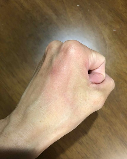 オールインワンホットクレンジング/sakuraim/クレンジングジェルを使ったクチコミ(3枚目)