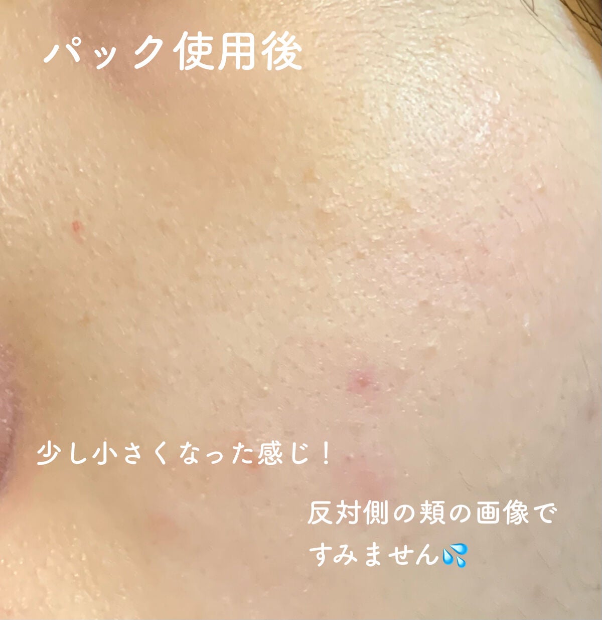 ルルルンピュア 白(クリア)/ルルルン/シートマスク・パックを使ったクチコミ(3枚目)