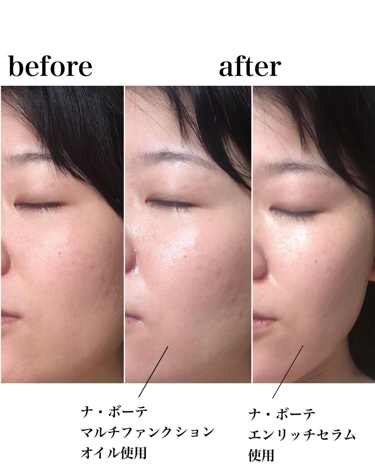 マルチファンクションオイル/ナボーテ/フェイスオイルを使ったクチコミ(7枚目)