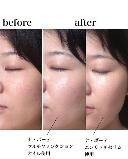 マルチファンクションオイル/ナボーテ/フェイスオイルを使ったクチコミ(7枚目)