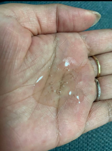 スキンソリューションSOSセラム100ml/FAU/美容液を使ったクチコミ(1枚目)