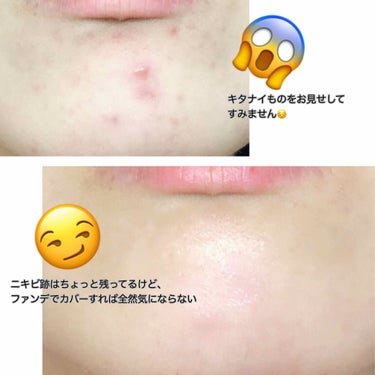 セリナ on LIPS 「※個人感想※今年の上半期で一番お気に入りかも🤔・・国産シカコ..」（2枚目）