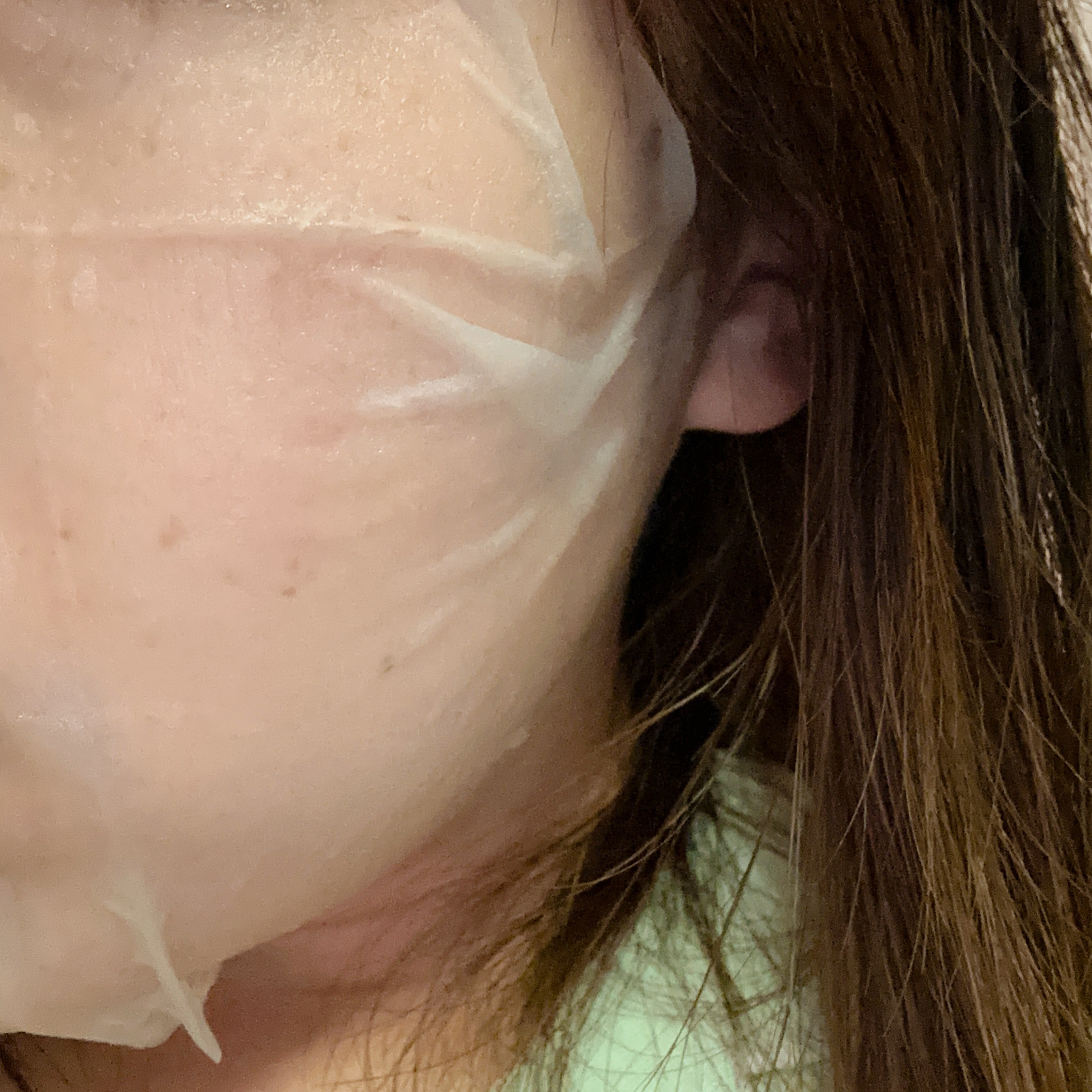 ダーマレーザー スーパーNMN100マスク/クオリティファースト/シートマスク・パックを使ったクチコミ（3枚目）