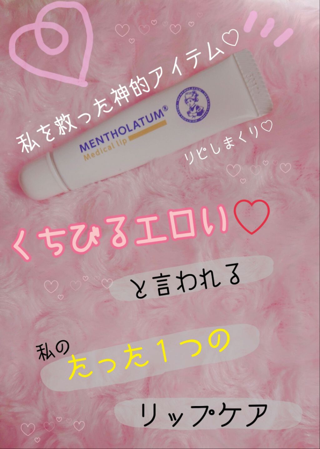 モアリップｗ(医薬品)/資生堂薬品/その他を使ったクチコミ（1枚目）