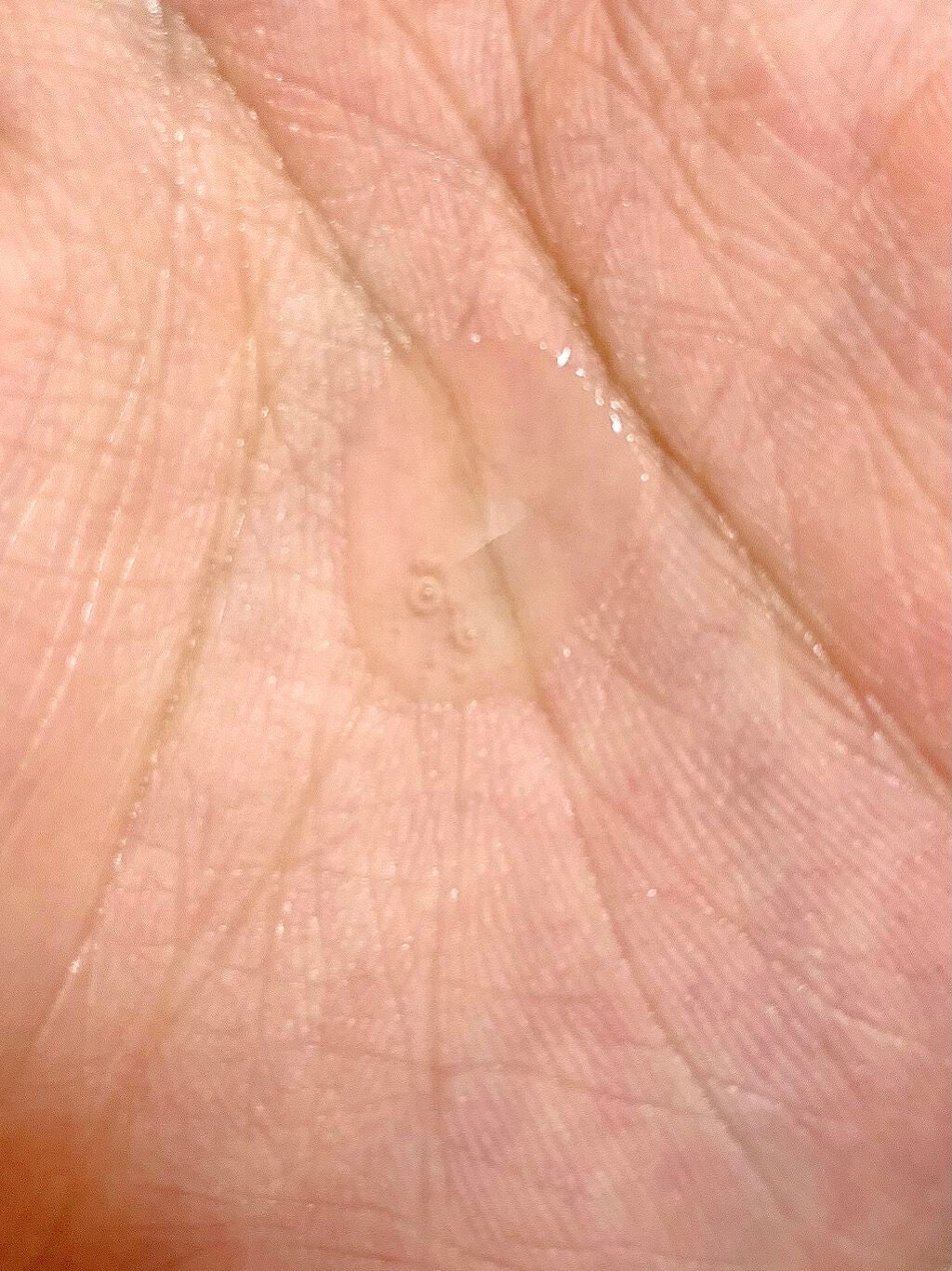 美白美容液 W/ちふれ/美容液を使ったクチコミ(3枚目)