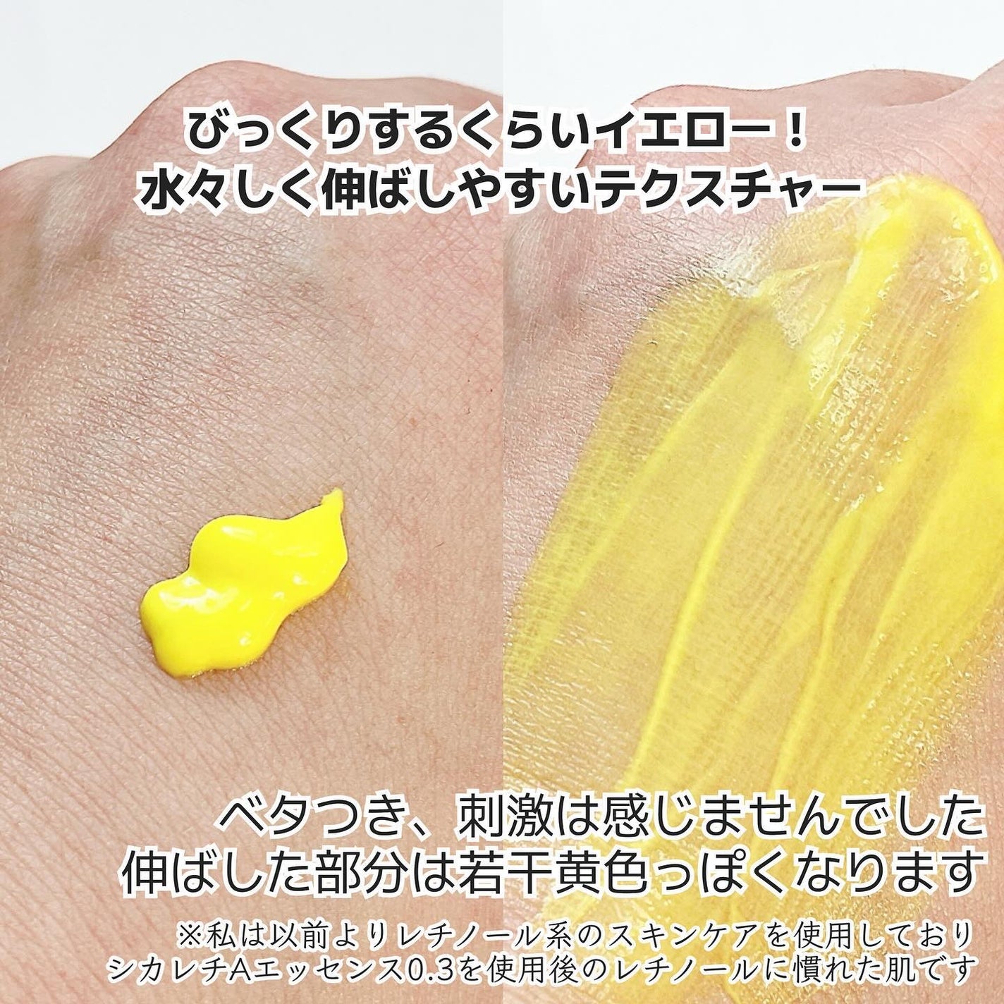 シカレチA エッセンス0.7/VT/美容液を使ったクチコミ(3枚目)