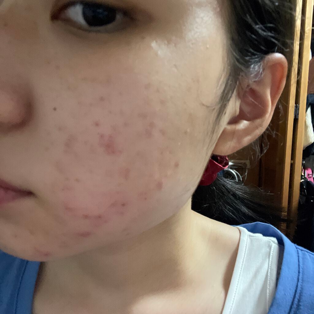 ザ・タイムR アクア/IPSA/化粧水を使ったクチコミ(1枚目)