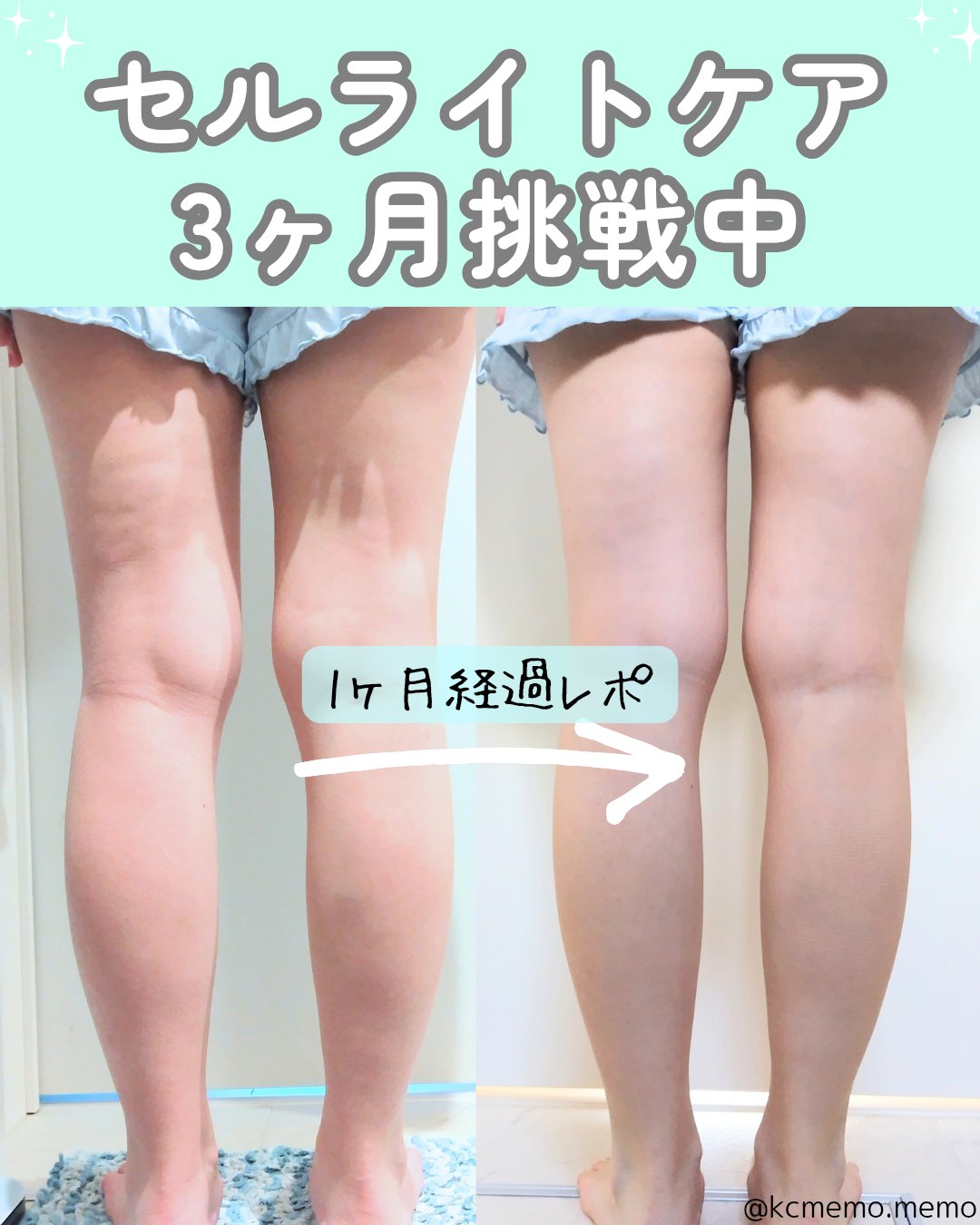 FRACORA Body Line Non Celula/fracora/ボディサプリメントを使ったクチコミ（1枚目）