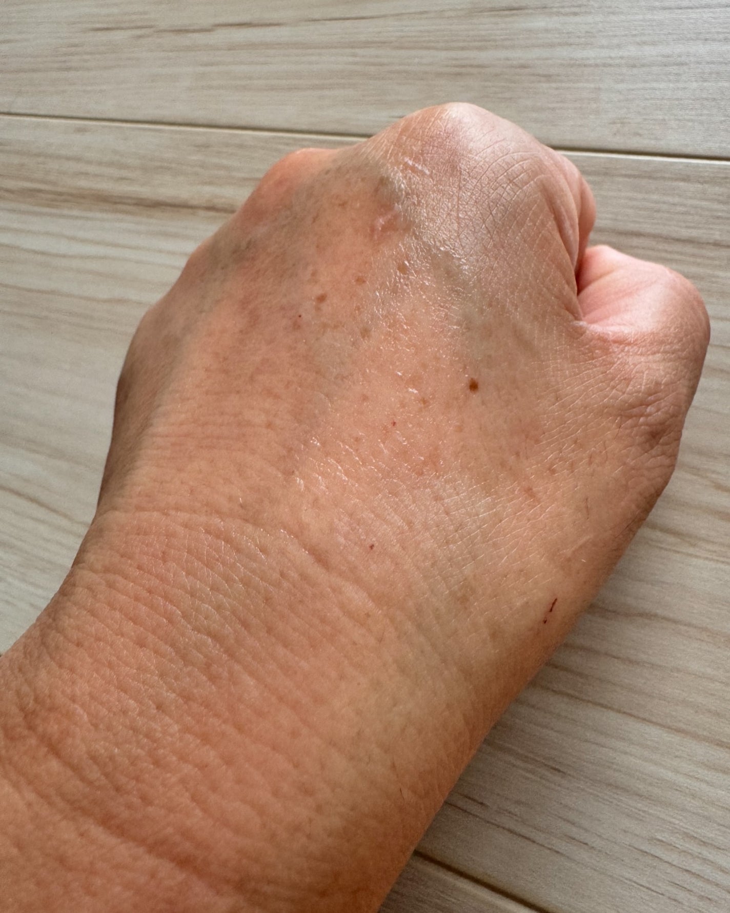 pikopiko on LIPS 「UIQ<ユイク>バイオームビタC(黒クマアイパッチ)60枚こん..」(4枚目)