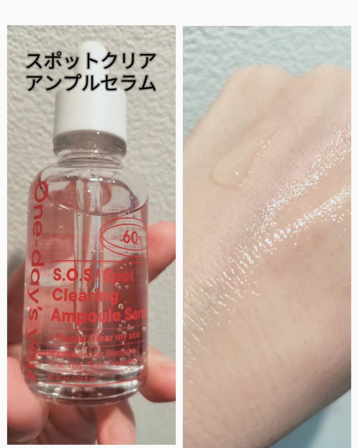 美容大好きにくちゃん@フォロバ100 on LIPS 「♚One-day'syouS.O.S!スポットクリアトナー/ス..」(3枚目)