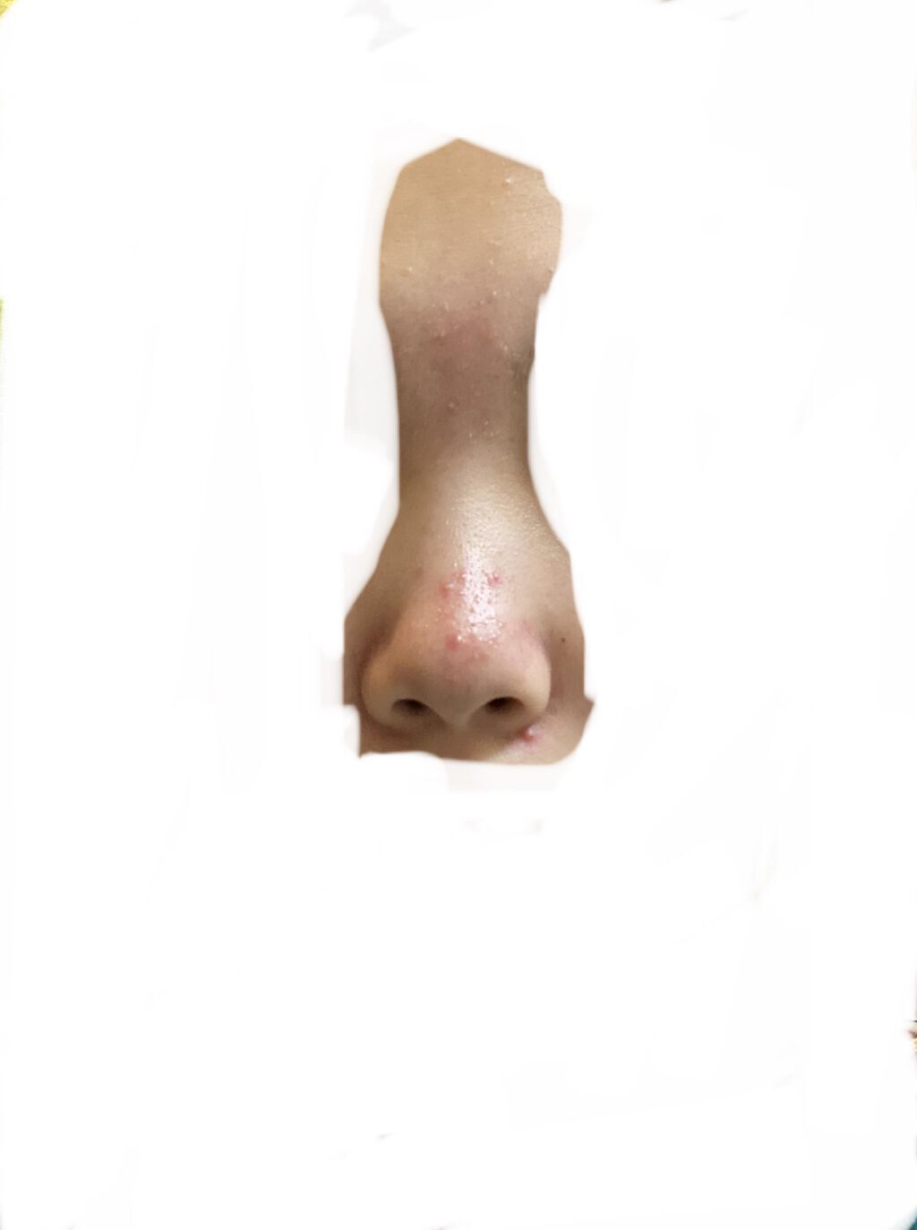 マスクパックティーツリー/DAISO/シートマスク・パックを使ったクチコミ（1枚目）