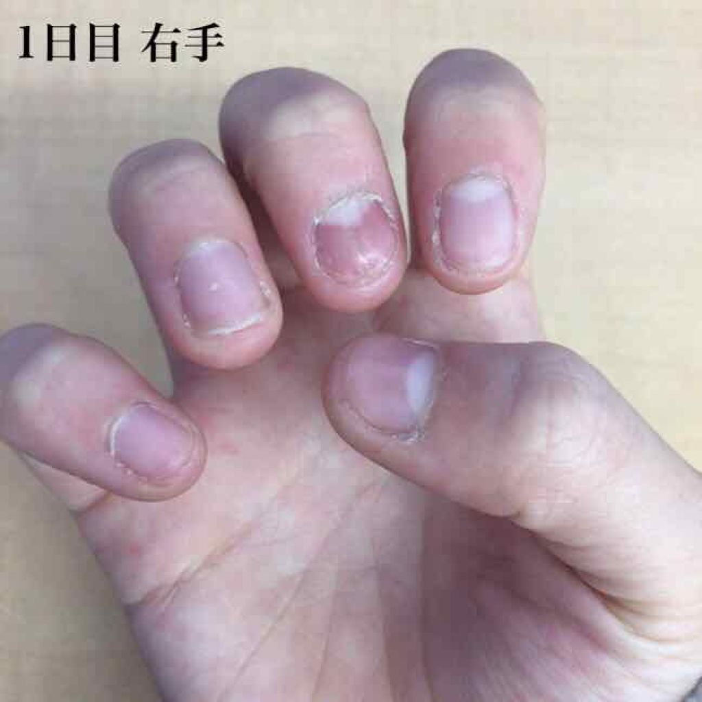 ピンクピンク on LIPS 「私は爪を噛んでしまうという癖が小さい頃からあります!しかし、も..」(2枚目)