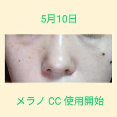 伊菜夏(いなか) ※ 体調不良でお休み中 on LIPS 「メラノCCを使い始めて一週間経過しました。鼻まわりや頬骨辺りの..」（3枚目）