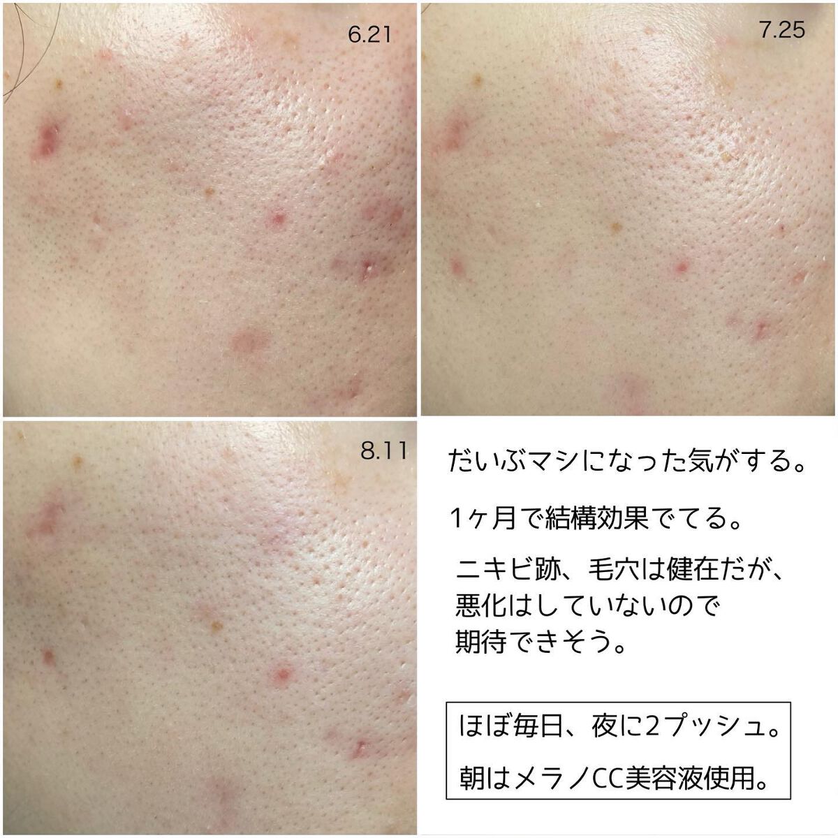 レチノール　シカ　リペア　セラム/innisfree/美容液を使ったクチコミ（2枚目）