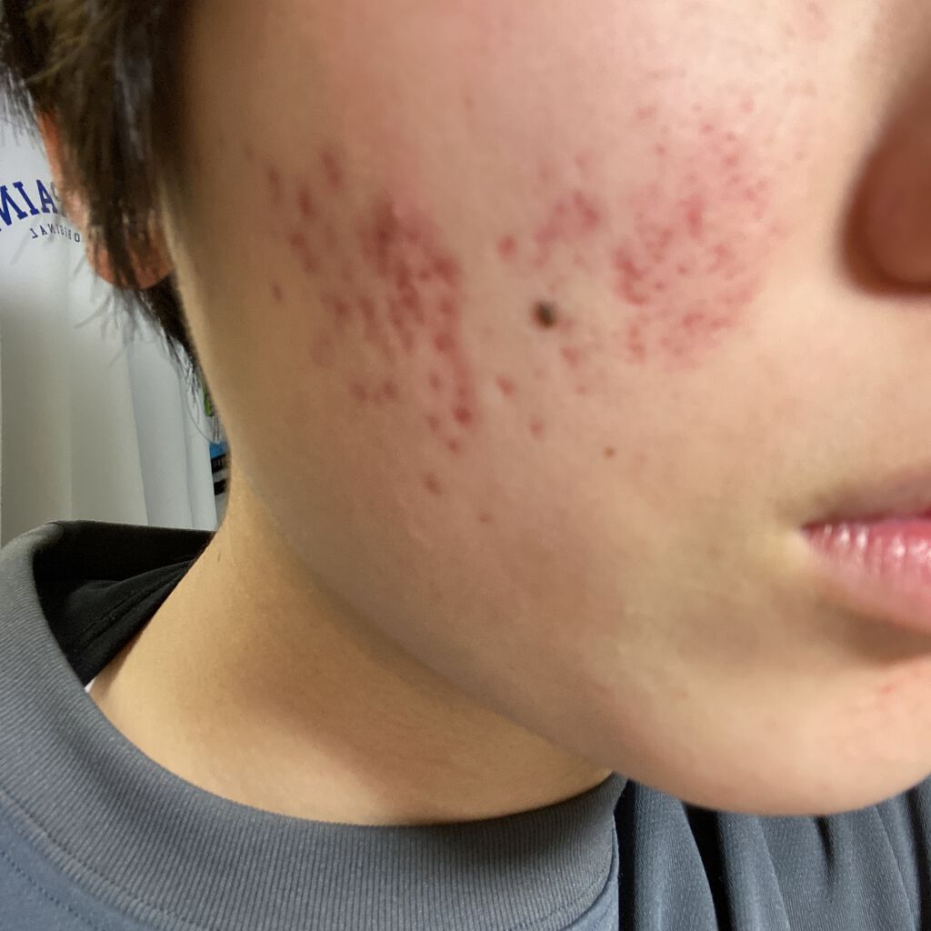 を使ったクチコミ（1枚目）