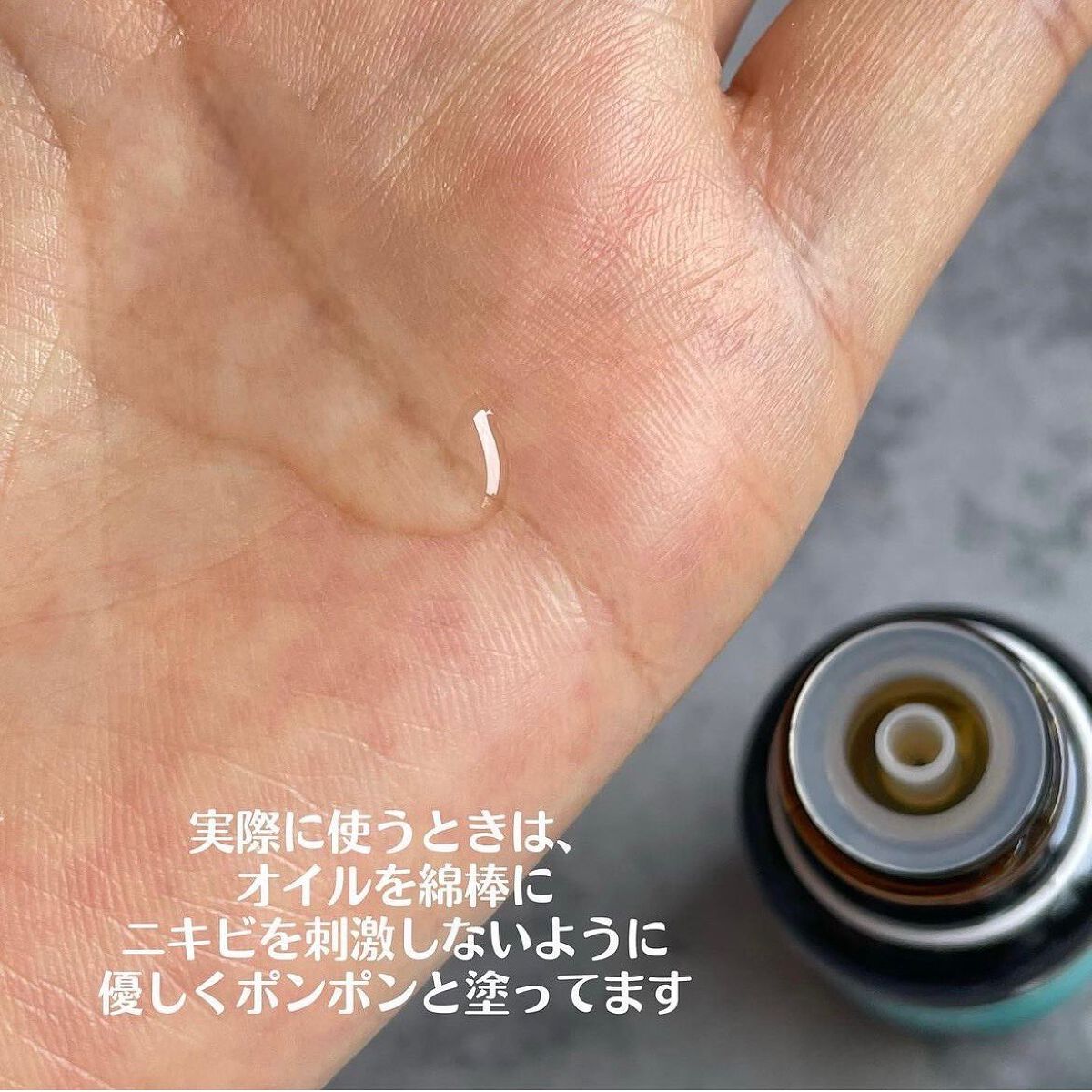 マジックティーツリーオイル/ブラン/フェイスオイルを使ったクチコミ(4枚目)