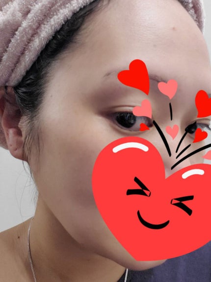 ヒートブースター /ESS/ブースター・導入液を使ったクチコミ(3枚目)